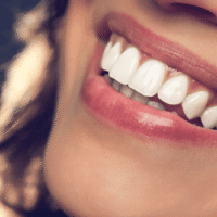 hollywood-smile-turkey-Cost